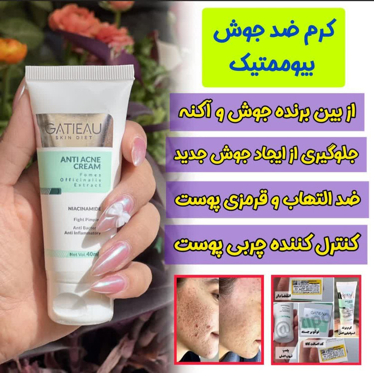 کرم ضد جوش و لک گاتیو ایتالیا اصل | قویترین درمان