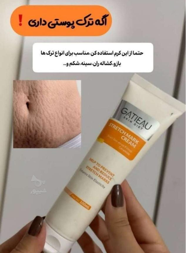 خرید کرم درمان ترک بارداری و استرچ مارک گاتیو ۱۰۰ میل